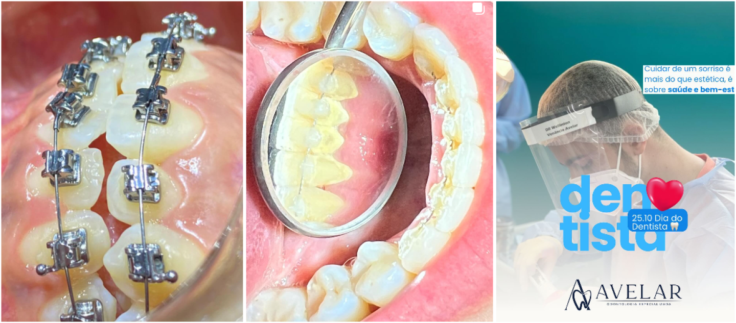 AVELAR ODONTOLOGIA ESPECIALIZADA 